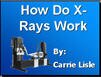 Filename=X-rays_CarrieL04.ppt Filesize=711KiB Dimensions=0x0 Date added=Nov 09, 2006 X-rays_CarrieL04.ppt