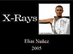 Filename=Xrays_EliasN.ppt Filesize=2397KiB Dimensions=0x0 Date added=Nov 09, 2006 Xrays_EliasN.ppt