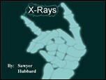 Filename=Xrays_SawyerH.ppt Filesize=1081KiB Dimensions=0x0 Date added=Nov 09, 2006 Xrays_SawyerH.ppt
