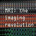 MRI MRI